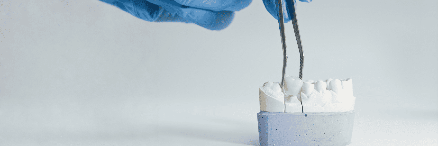 Crowns & Bridges | Dentist